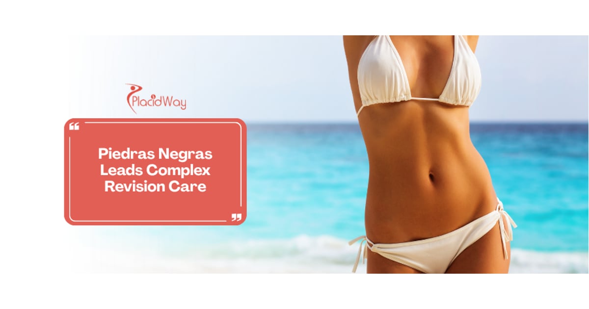 Fixing the Past: Why US Medical Tourists Trust Piedras Negras for Complex Bariatric Revision Surgeries
