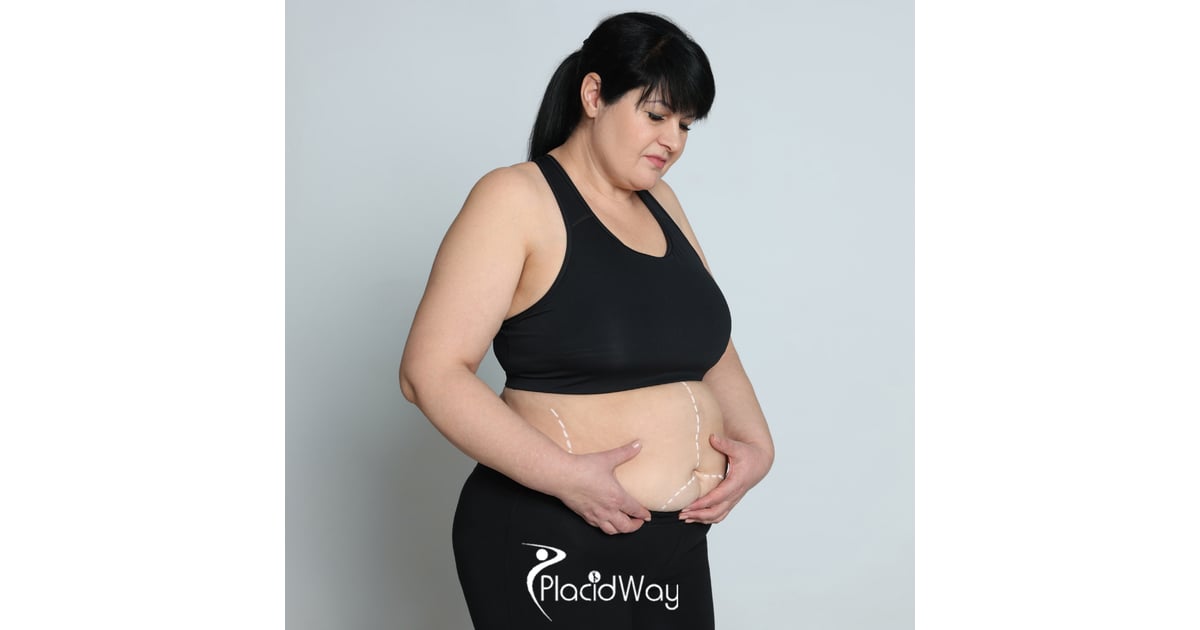 Gastric Sleeve in Turkey vs Spain - Comparing €4,000 All-Inclusive Packages for Irish Seekers, Brands, and Quality Standards Compared