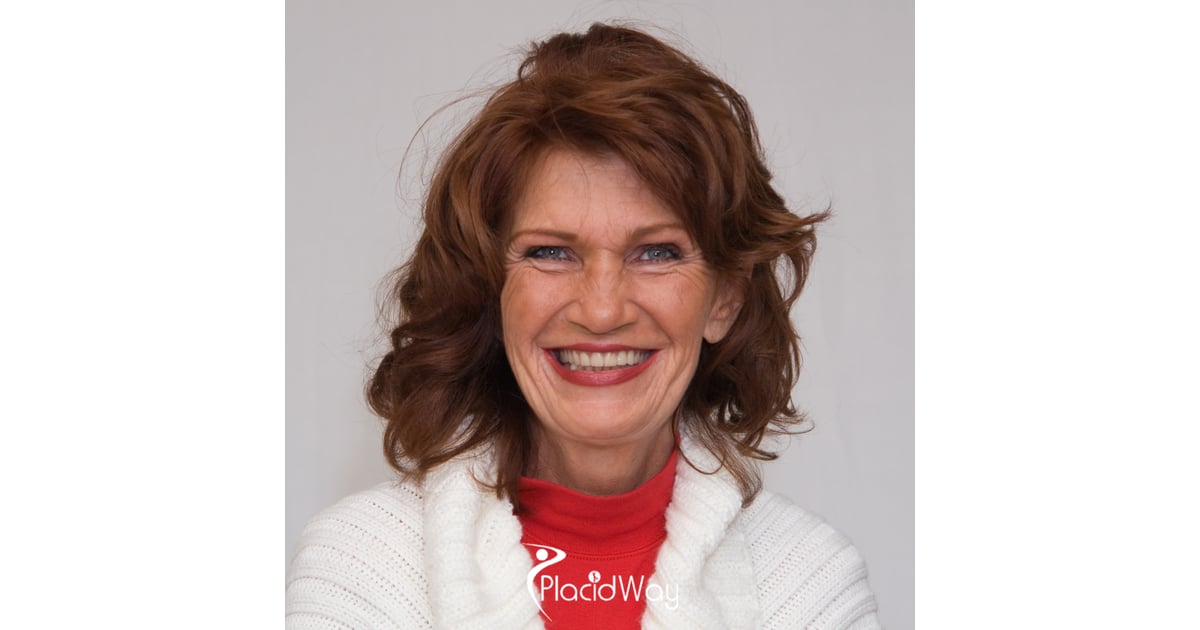 8 Benefits of 3-on-6 Acrylic Dentures in Molar City for Canadian Snowbirds