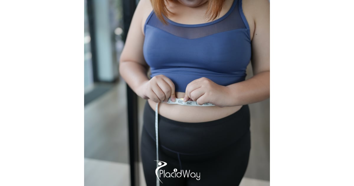 Gastric Bypass in Turkey vs Latvia - Navigating Language Barriers and Post-Op Care for Scandinavians, Brands, and Quality Standards Compared