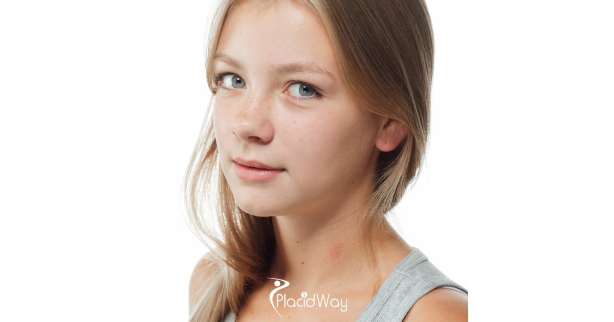 7 Things Young Adults in the US Should Ask Before Getting a Rhinoplasty in Tijuana