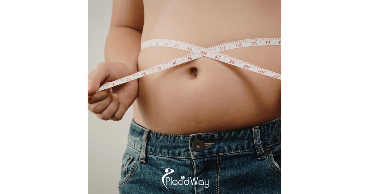 7 Reasons US Patients Choose Single-Incision Gastric Sleeve in Tijuana for Faster Recovery