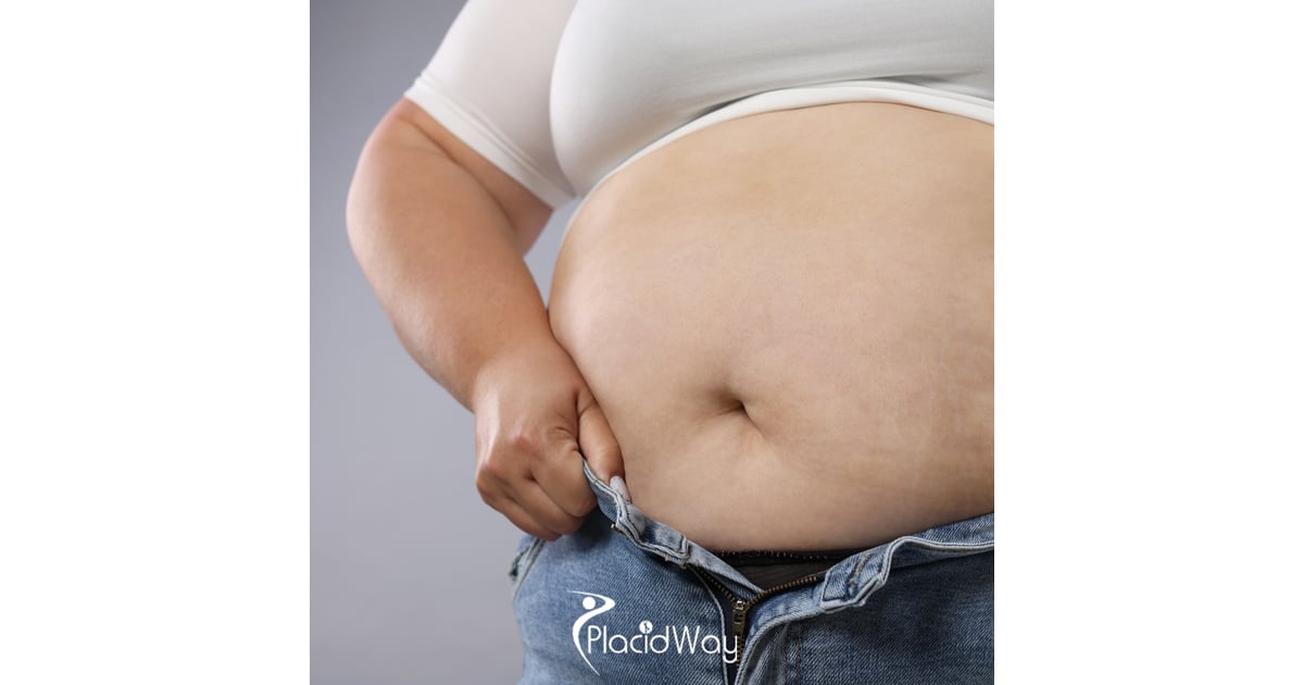 6 Proven Benefits of Roux-en-Y Gastric Bypass in Mexico for Diabetic Texans