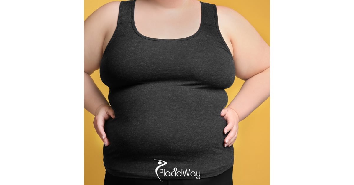 8 Recovery Tips for American Patients Undergoing Duodenal Switch in Piedras Negras