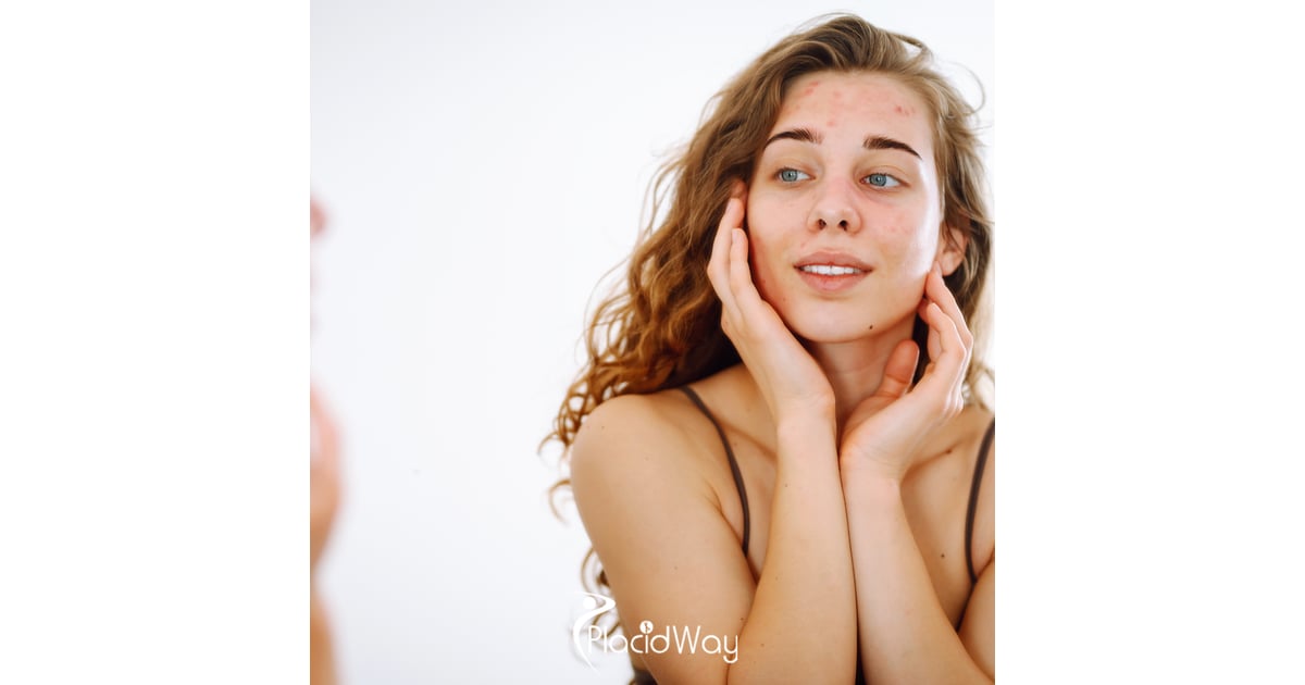 6 Reasons US Patients with Lupus Are Choosing Cellular Therapy in Tijuana Over Traditional Meds