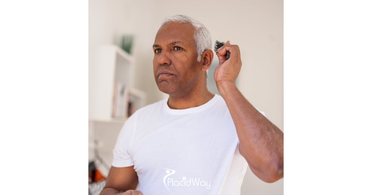 Hair Transplant in Turkey vs Saudi Arabia - DHI Technique Success, Expert Clinics, and Package Deals Compared for Saudi Men