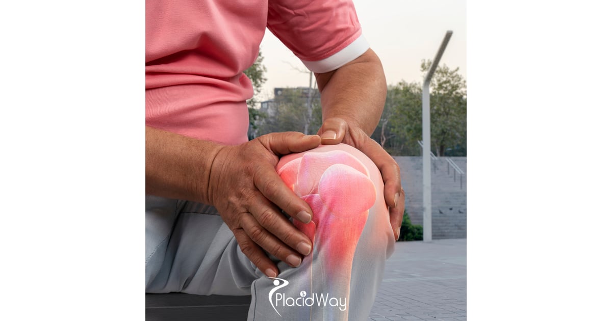 7 Hidden Costs You Avoid with Total Knee Replacement in Mexico for US Patients
