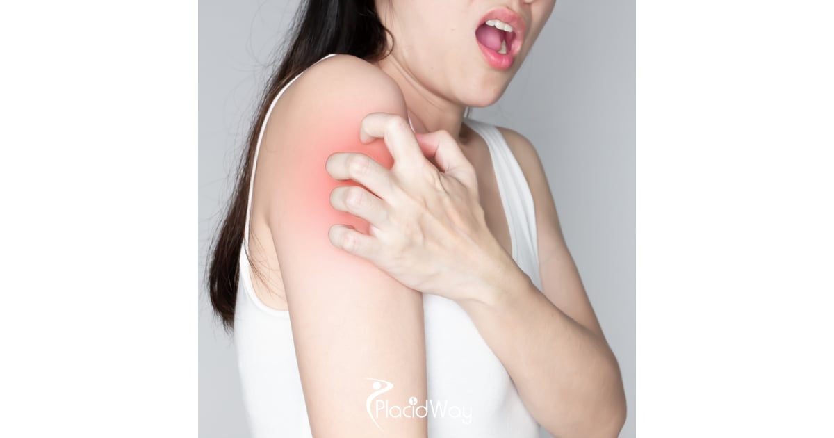 6 Facts for US Patients on Intravenous Stem Cell Therapy for Lupus in Colombia
