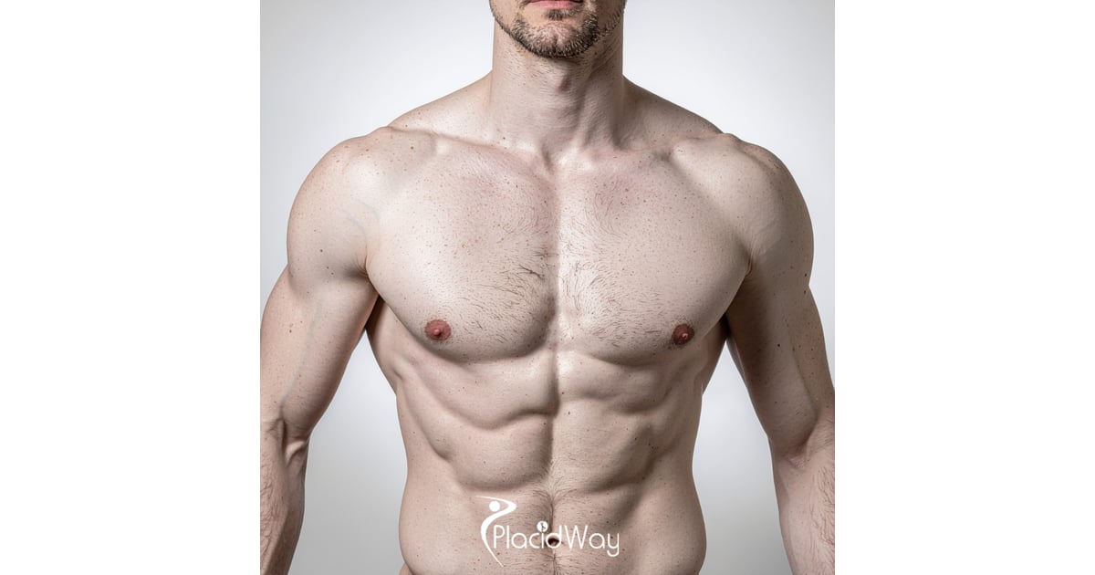 7 Gynecomastia Surgery Options in South Korea That Are Attracting Male Patients From the UK and UAE