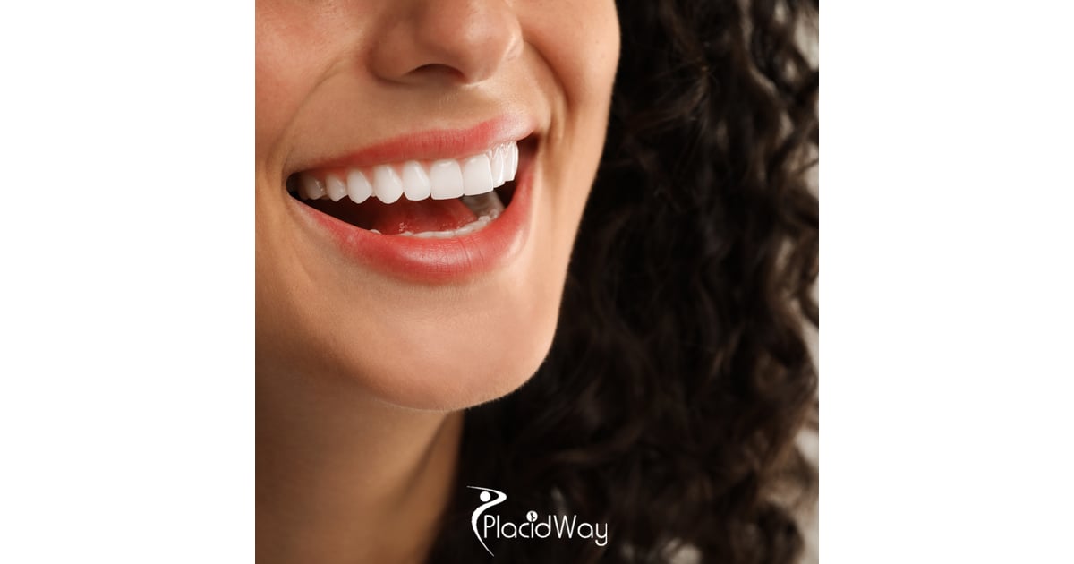 E-max vs Zirconium Veneers in Turkey: 7 Facts UK Cosmetic Patients Need to Decide