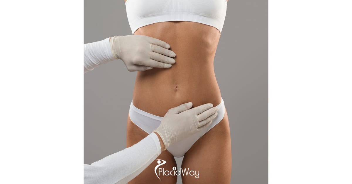 7 Reasons UK Patients Are Choosing Gastric Sleeve Surgery in Turkey Over NHS Waitlists