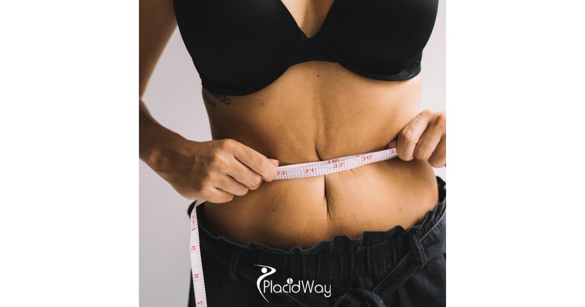 7 Reasons UK Patients Are Switching from Sleeve to Roux-en-Y Gastric Bypass in Istanbul