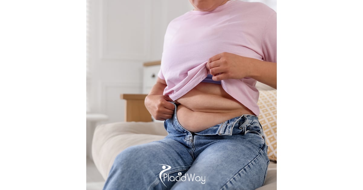 Benefits of Metabolic Gastric Bypass Surgery in Turkey for Patients with Type 2 Diabetes