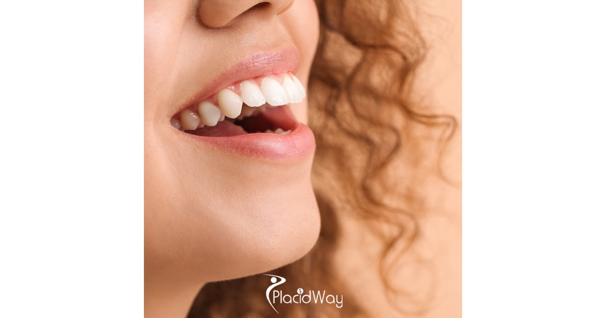 Precision Porcelain: How Escazú’s Boutique Labs are Outpacing US Dental Standards for Single-Visit Zirconia Crowns