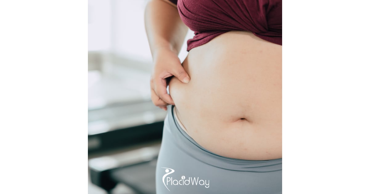 Tummy Tuck Gangnam Korea: Secret to Flawless Abdominal Contouring