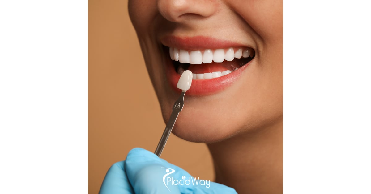 The Urban Glow-Up: Why Zagreb is the Hub for Ultra-Thin, Natural-Looking Veneers