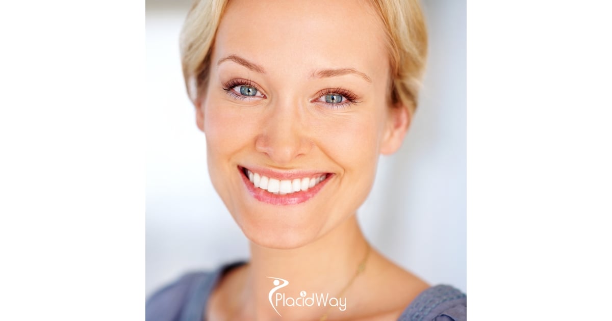 Why 2026 Trends in Alexandria Favor Ultra-Thin & No-Prep Porcelain Artistry?