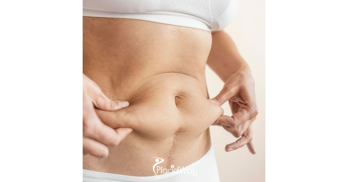 Why are Specialized Hospitals the Gold Standard for Post-Baby Restoration in HCMC?