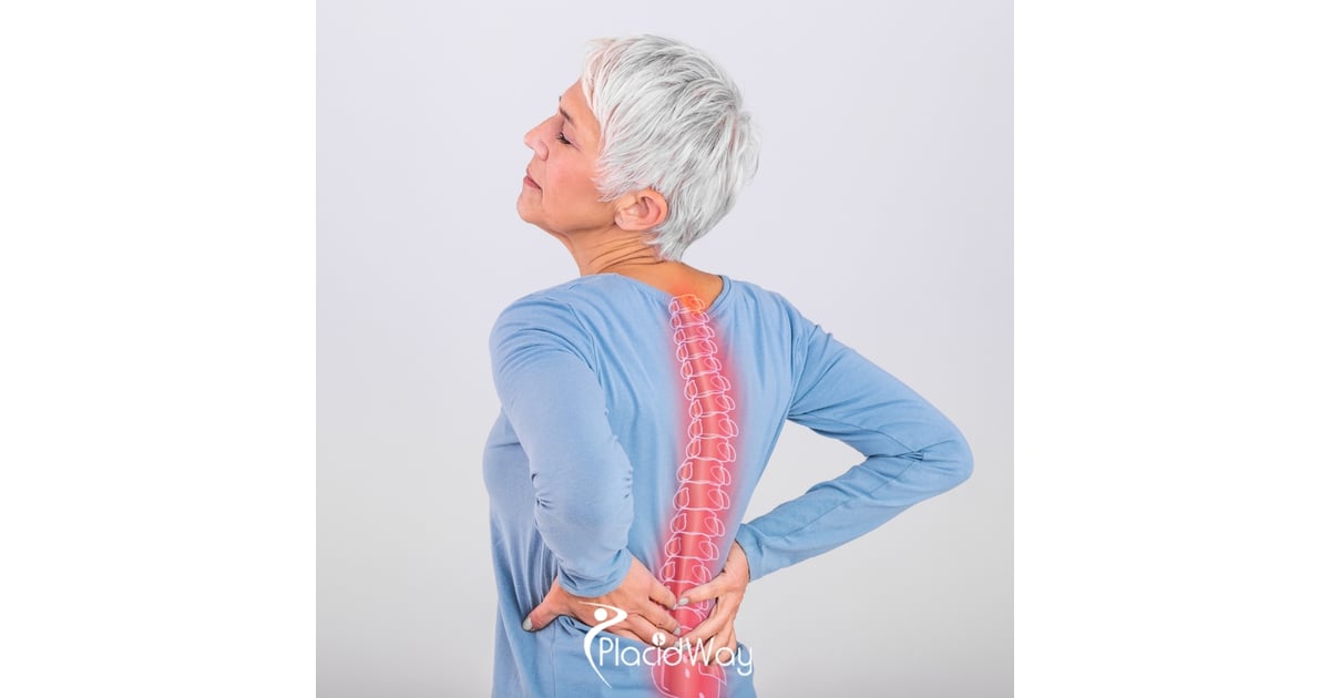 Affordable Spine Surgery in Turkey for Romanian Patients: Costs, Recovery, and Clinic Guide