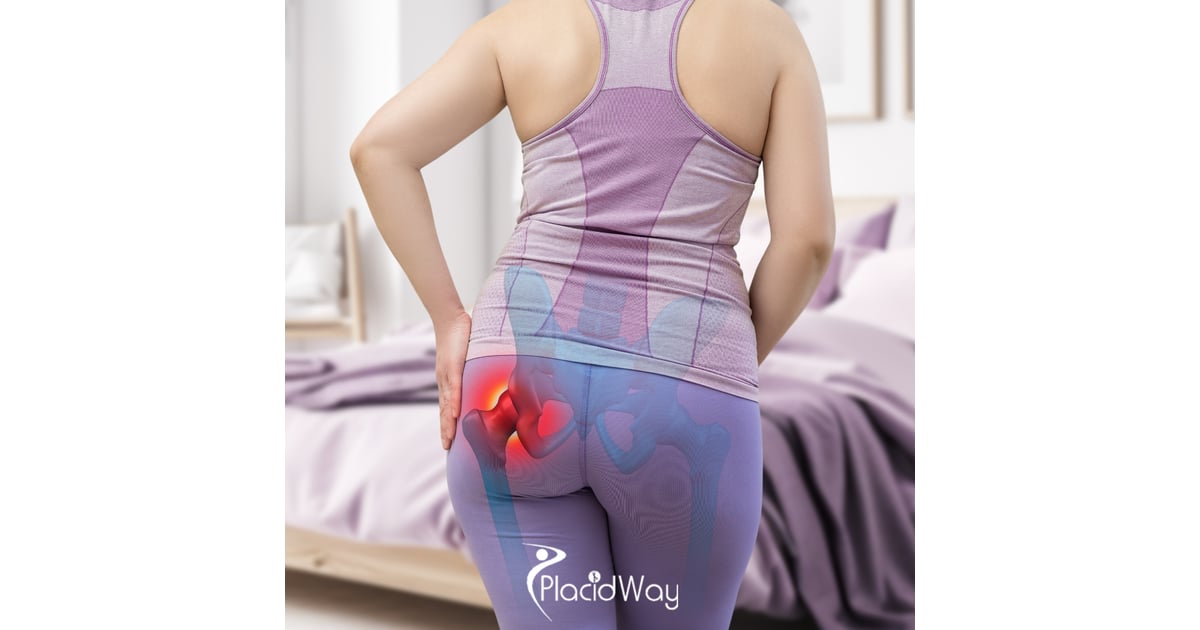 Minimally Invasive Hip Replacement in Istanbul: Booking to Recovery Guide for UK Patients