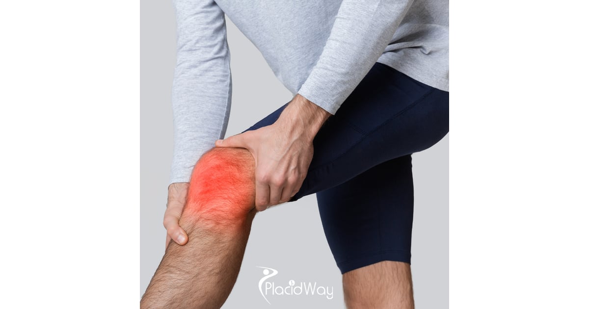 A Guide to Knee Replacement Surgery in Turkey