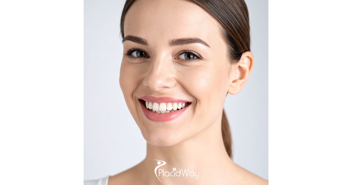 Dental Veneers in Albania for French Patients: Costs, Treatment Time & Travel Planning