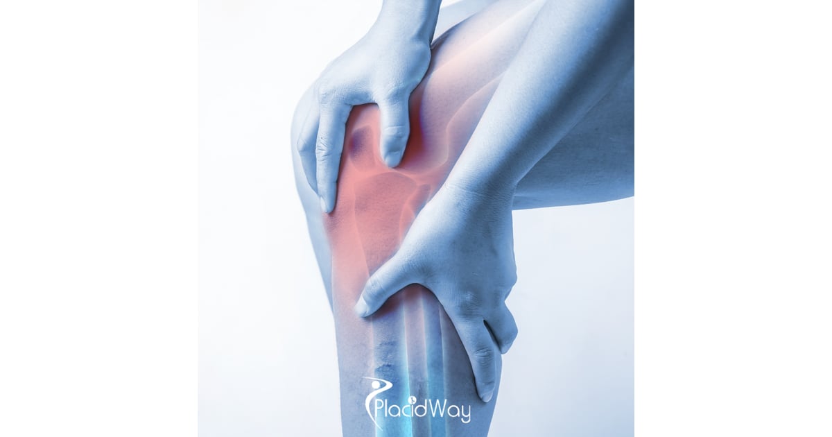 Knee Replacement Surgery: Mexico vs USA - Cost, Quality & Recovery