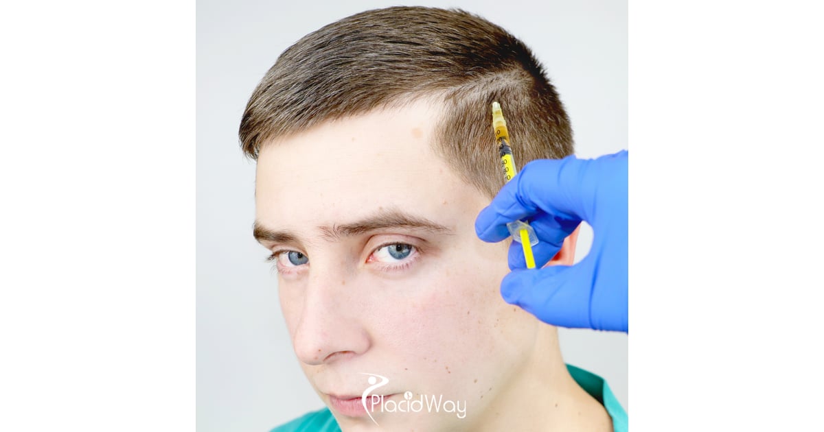 Stem Cell Therapy for Hair Regrowth in Japan: A Guide to Regenerative Restoration