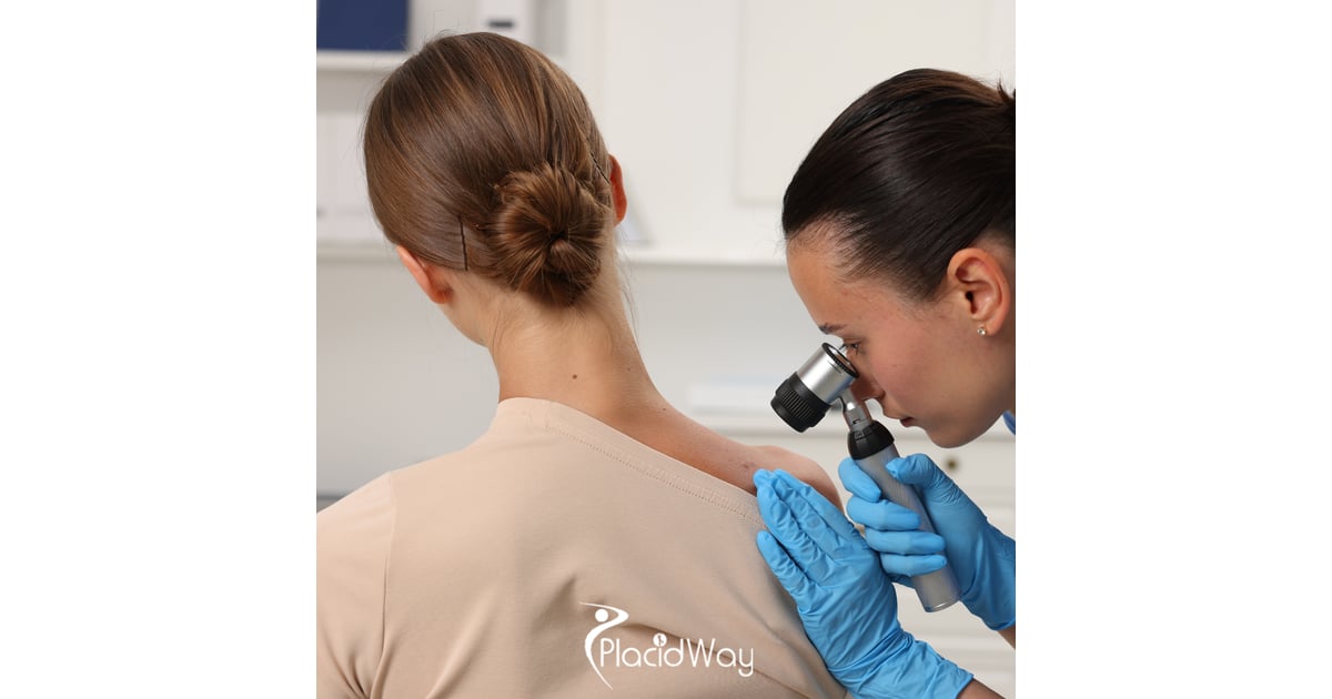 Melanoma Immunotherapy in Mexico: Trends, Patient FAQs, and Success Stories