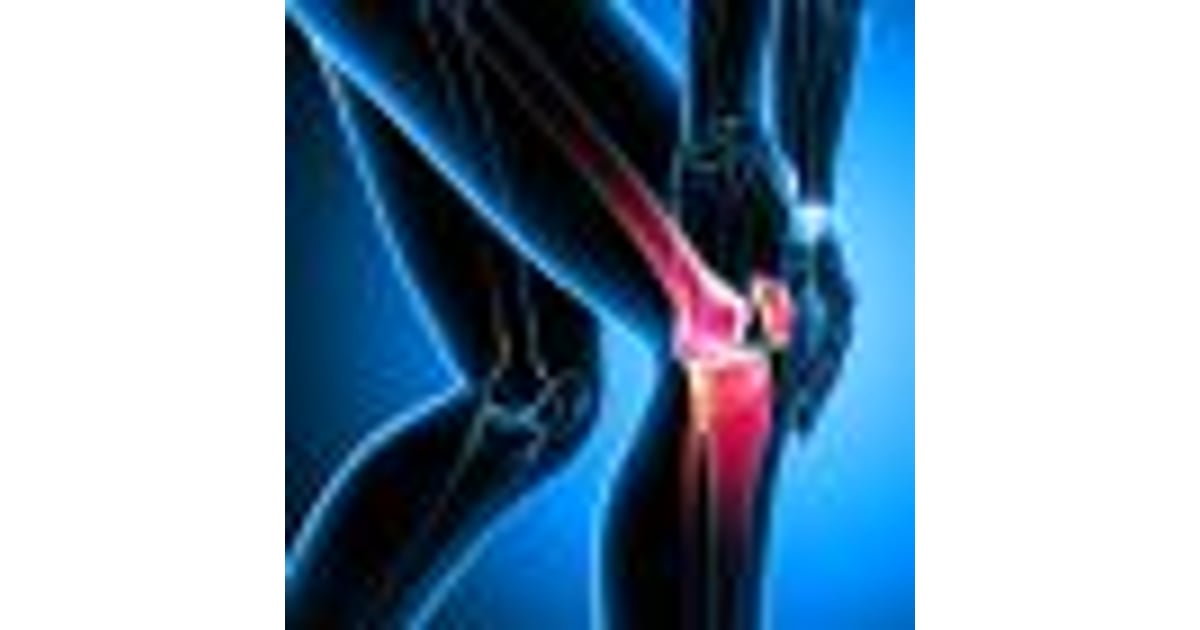 Do I have Arthrosis or Arthritis?
