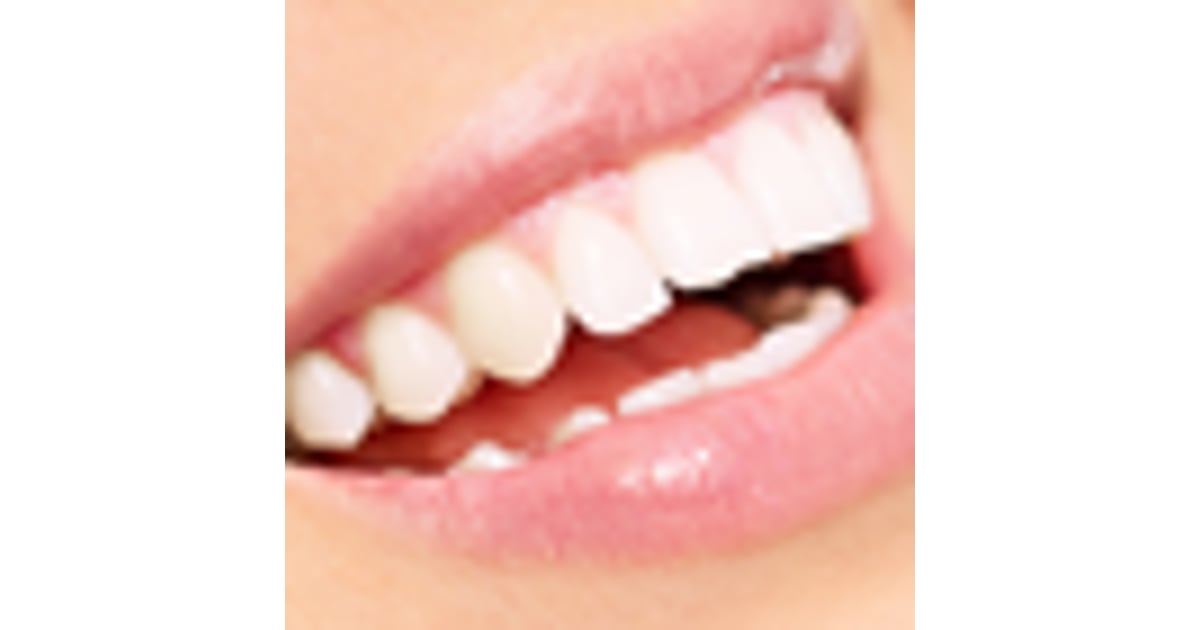 Implantes dentales en San José, Costa Rica - $700