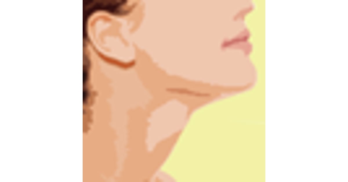 Key Factors to Know About the Neck lift Surgery in Mexico