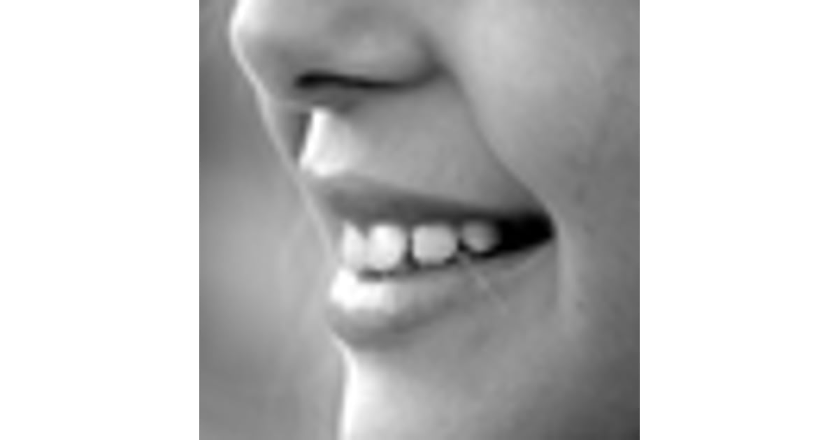 How to Search The Best Botox fillers Surgery in Mexico