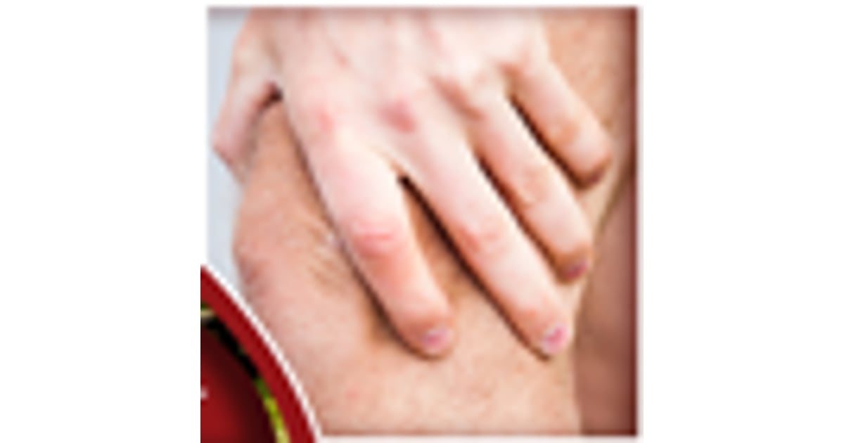 The Things to Know About Knee Replacement Surgery