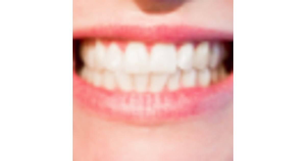 ¿Es seguro obtener implantes dentales en Costa Rica?