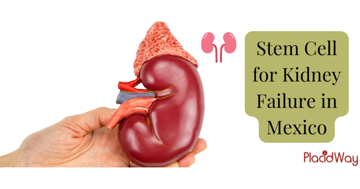 Stem Cell Treatment for Kidney Failure in Mexico
