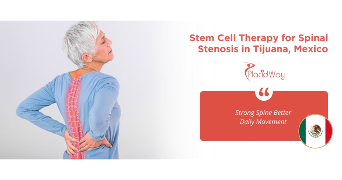 Stem Cell Therapy for Spinal Stenosis in Tijuana
