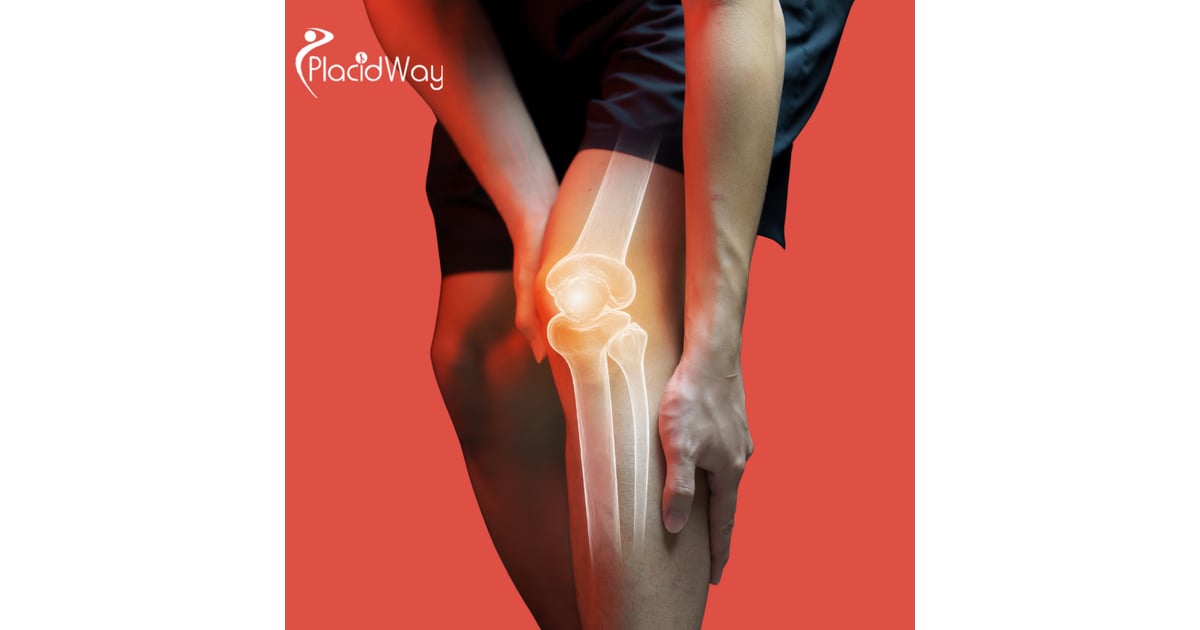 Dubai Becomes the Global Hub for Non-Surgical Knee Replacement via Advanced MSC Stem Cell Therapy