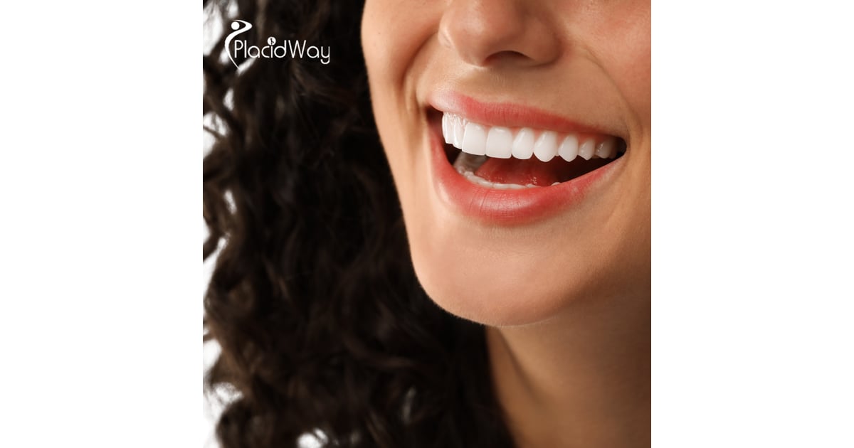 Veneers in Egypt: A 2026 Guide for International Patients Seeking the Perfect 