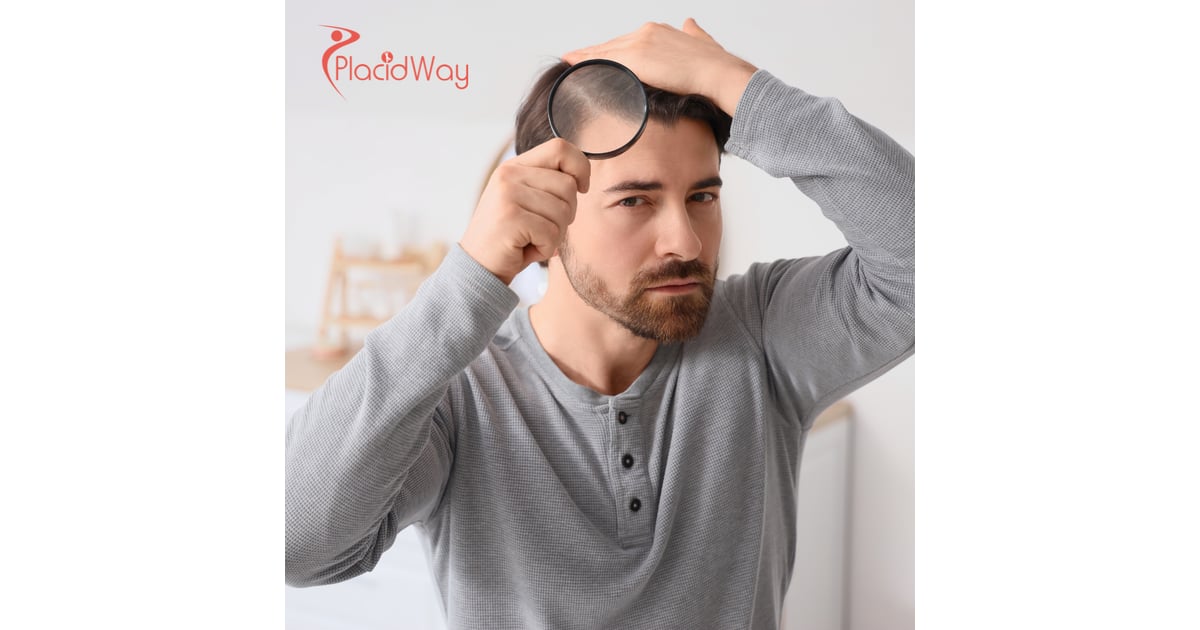 The 'Turkey Hair Transplant Plane' Viral Trend Highlights Istanbul's Dominance Among US and UK Men