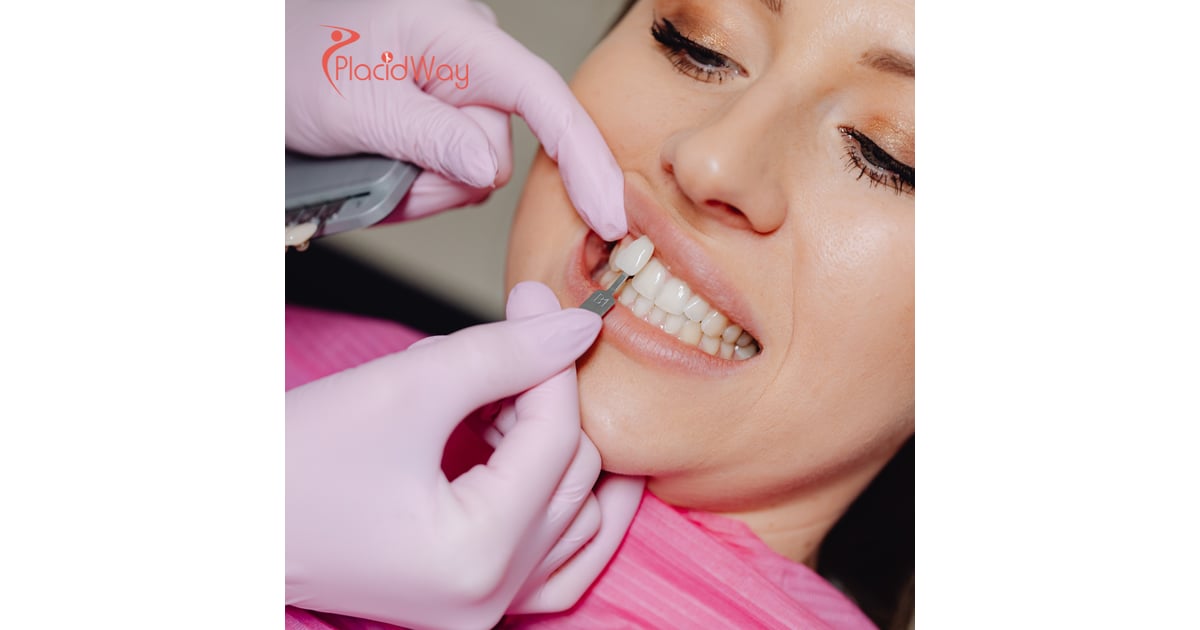 The 'Antalya Veneer' Takeover: How Turkey’s Mediterranean Coast Redefined Cosmetic Dentistry for Gen Z
