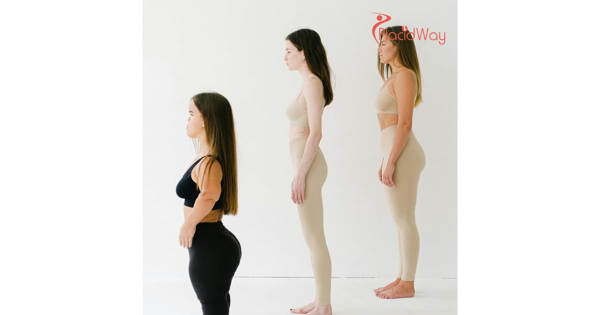 The 'Height Surgery' Viral Trend Highlights Istanbul's Leg Lengthening Dominance