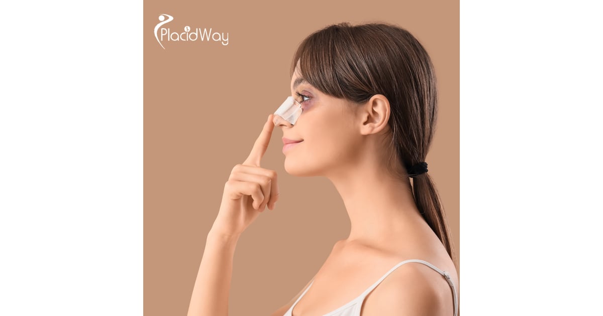 Why Istanbul is the 2026 Global Capital for Revision Rhinoplasty: Solving the World’s Botched Procedures
