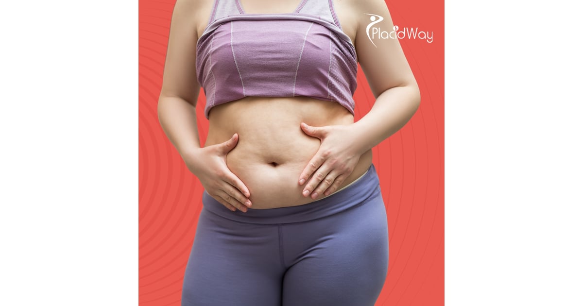 Restoring Confidence Overseas: Vietnam’s Surge in Tummy Tuck Procedures for New Zealand and Aussie Travelers