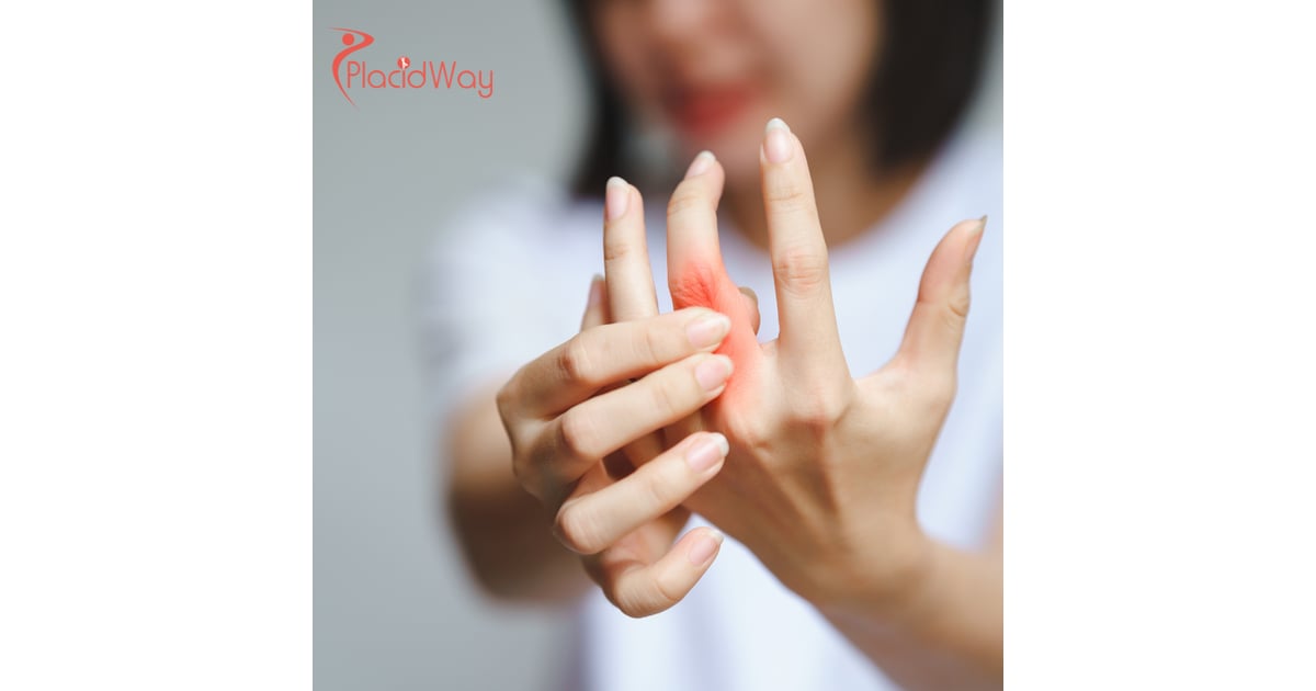 Rheumatoid Arthritis Relief: Why Australian Demand for Thailand’s MSC Therapy Has Tripled in 2026