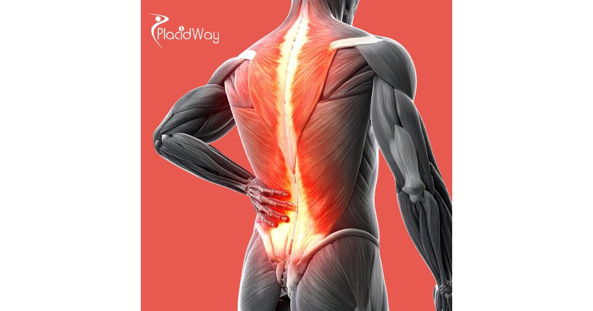 European Demand for Cervical Disc Replacement Surges in Turkey Amid Domestic Pricing Crisis