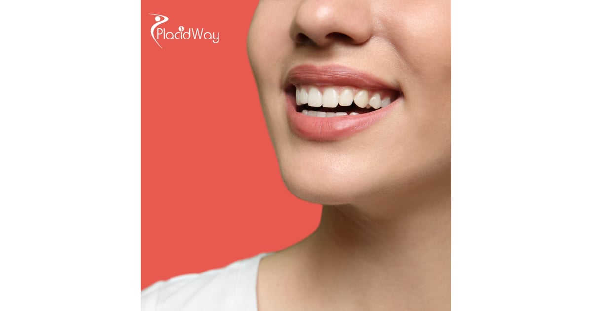 Canadians Trade Winter for New Teeth: All-on-4 Dental Tourism Booms in Cancun, Mexico