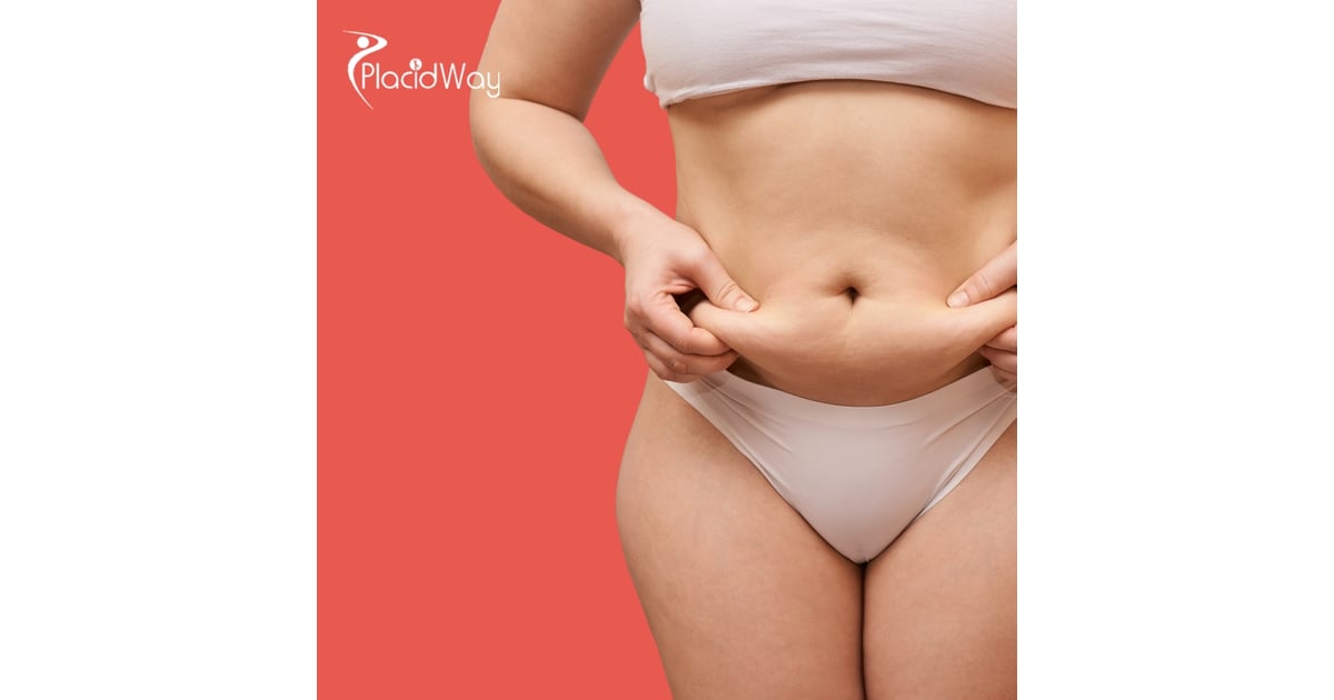 Post-Pregnancy Tourism: Mexico City, Mexico Sees Influx of U.S. Patients for Complex Body Contouring