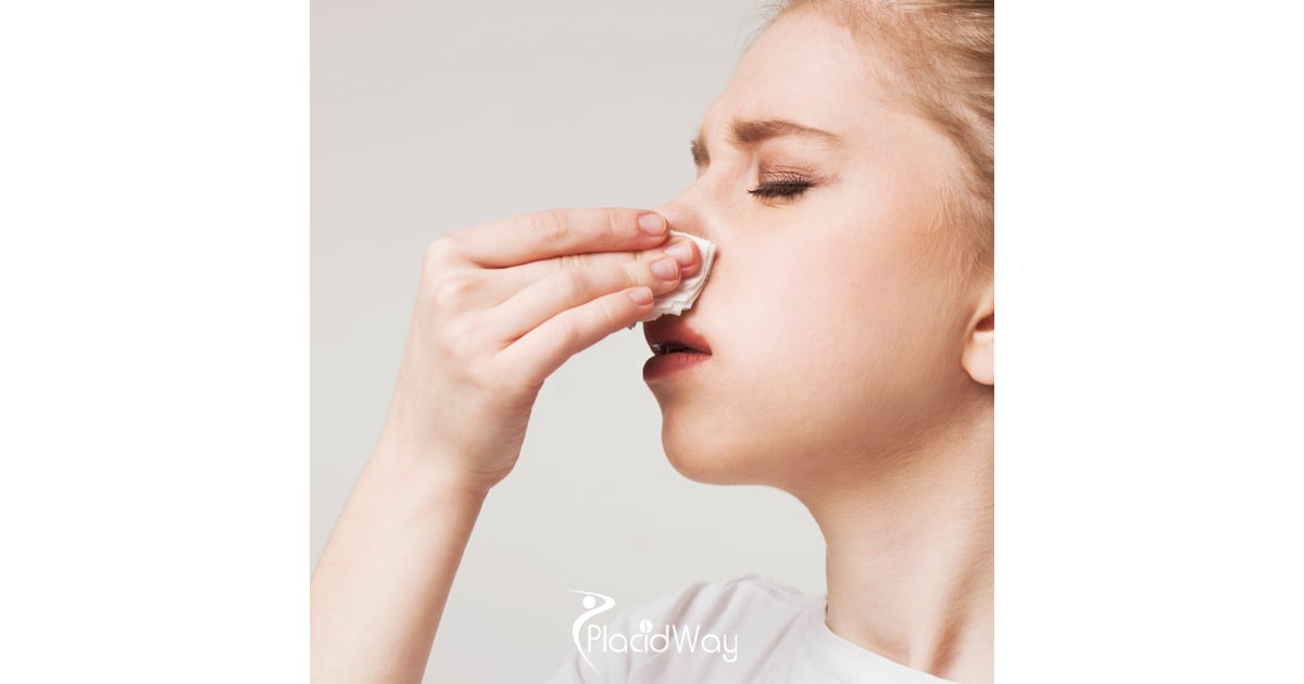 Medical Tourism Surge: Canadian Patients Finding Nose Cancer Solutions in Mexico