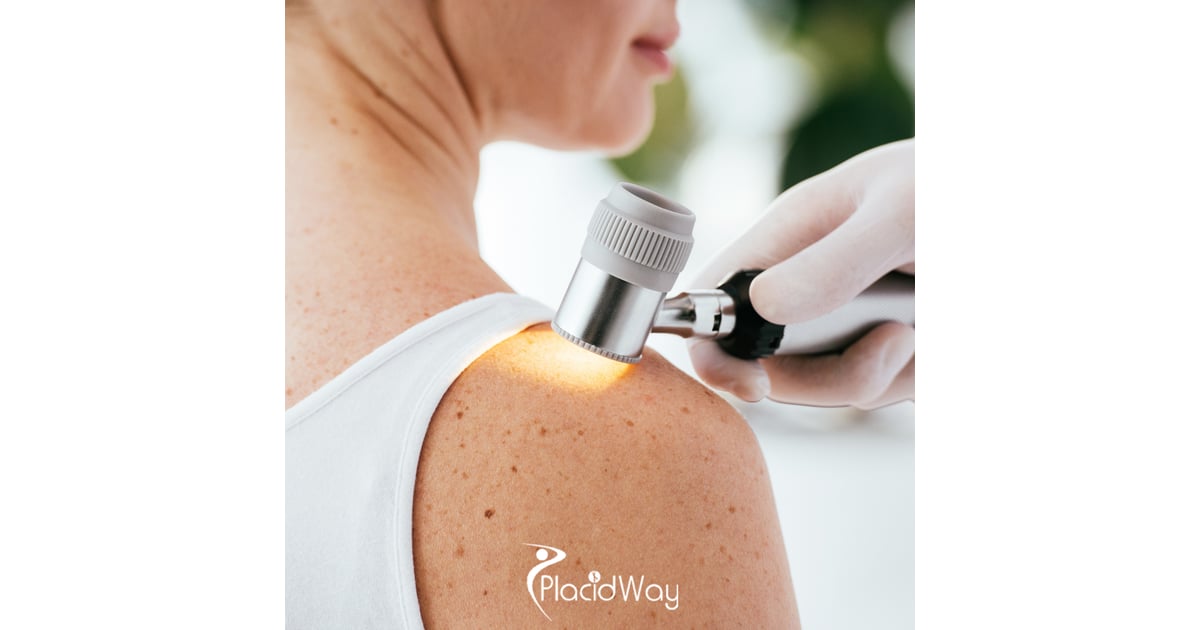 Affordable Melanoma Solutions: U.S. Patients Avoid Medical Bankruptcy with Mexico's Alternative Therapies
